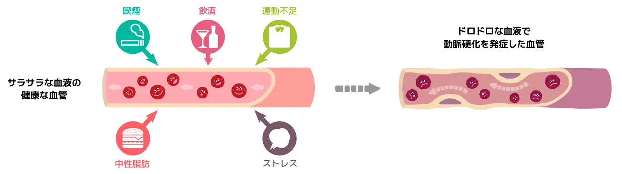 器質性EDのイメージ図