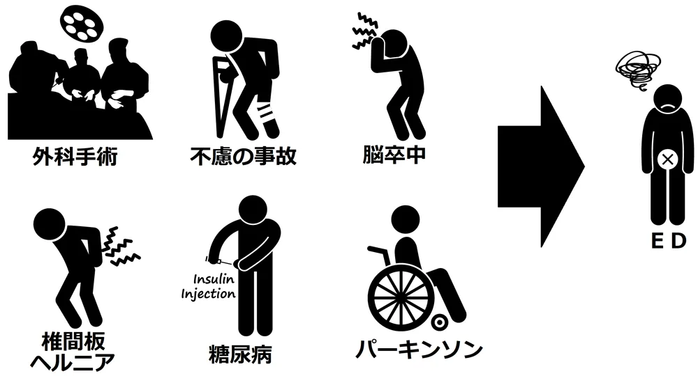 勃起を制御する神経経路図