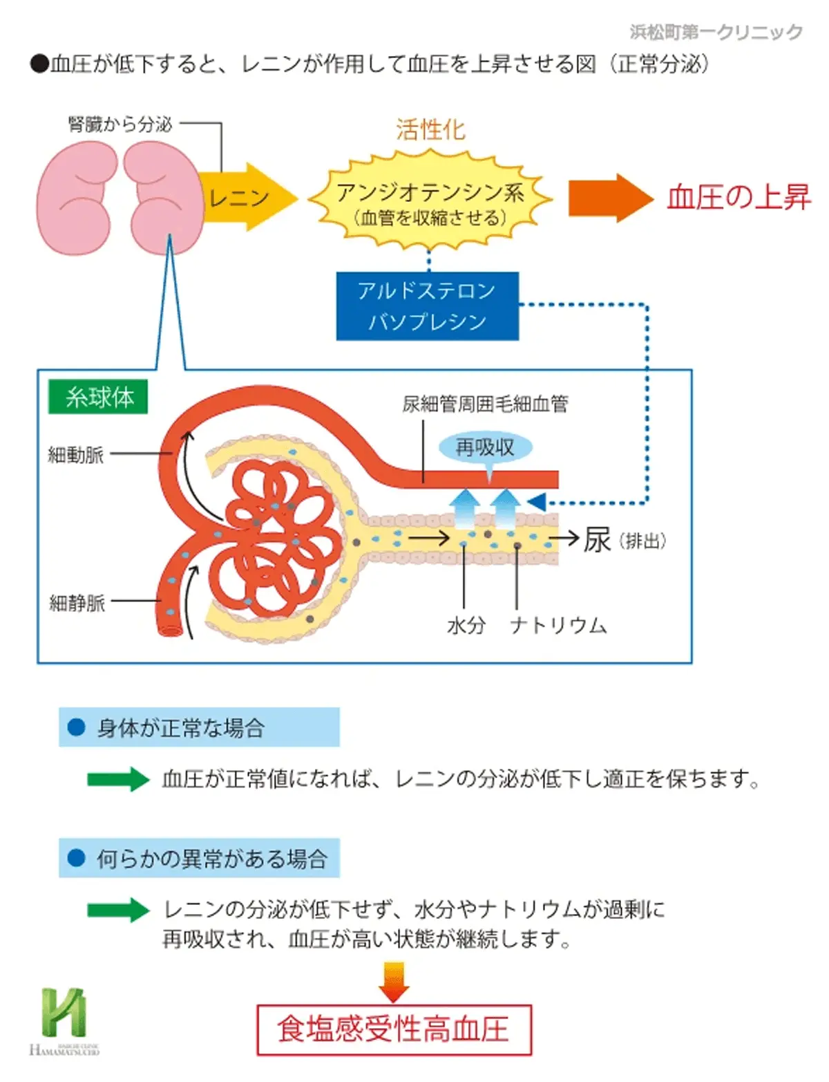 食塩感受性高血圧の仕組み
