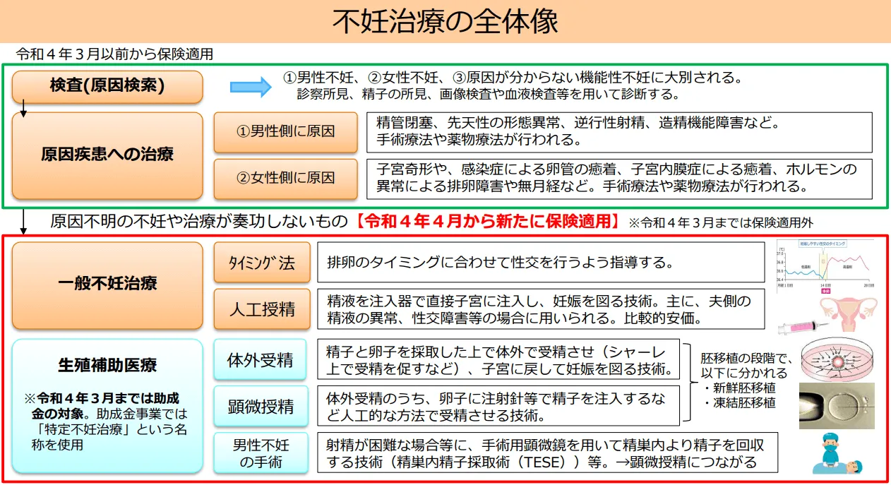 不妊治療の全体像