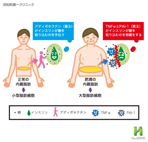 インスリン抵抗性と脂肪細胞の関係