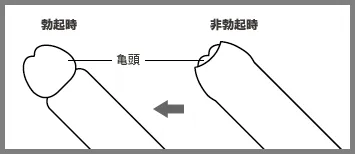 仮性包茎図解