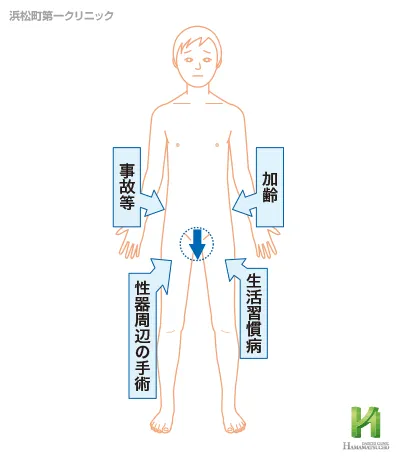 器質性EDの主な原因分類