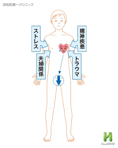 心因性EDの原因
