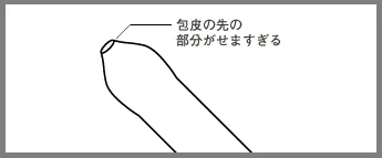 真性包茎図解