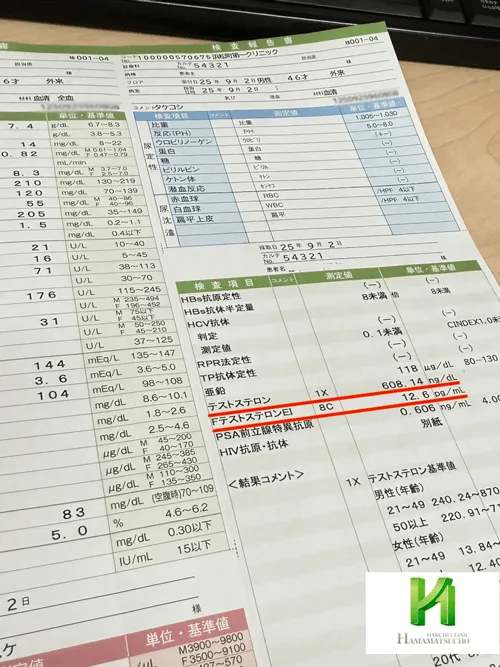 血液検査の結果に表示された総テストステロン値と遊離テストステロン値。男性更年期やホルモンバランスの評価に重要な検査項目。