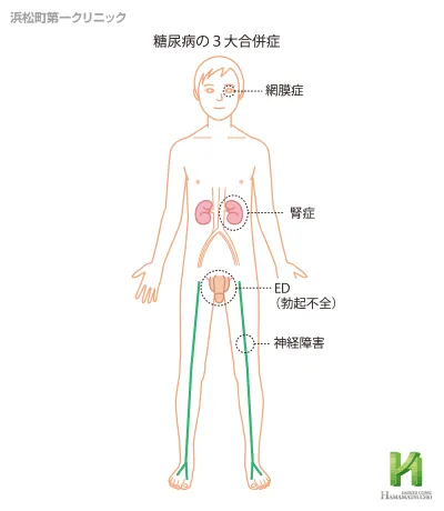 糖尿病3大合併症