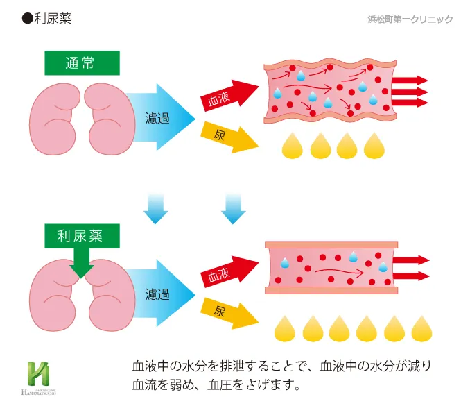 利尿剤の降圧作用