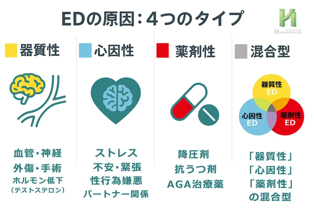 EDの原因は4つ：器質性・心因性・薬剤性・混合型を図解したインフォグラフィック