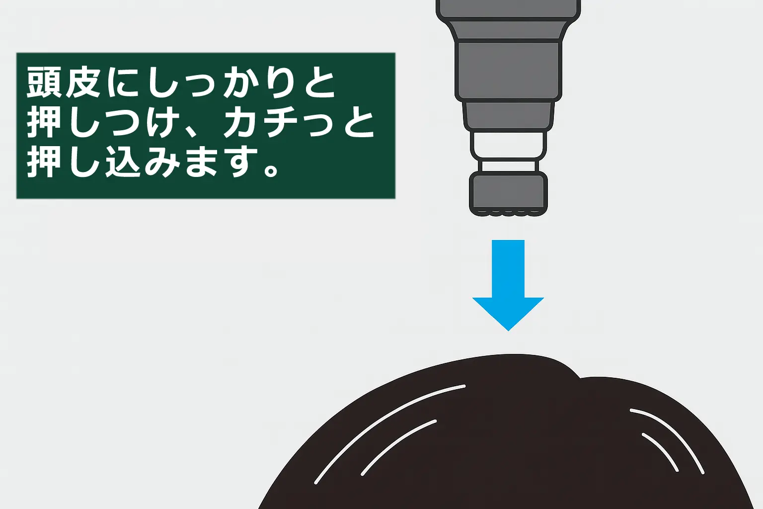 ミノキシジルFCIの塗布方法1