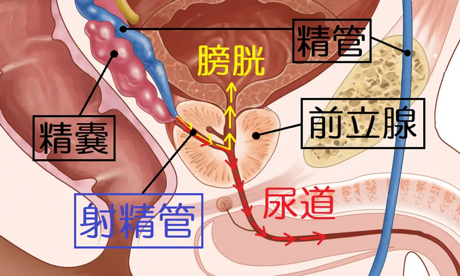 逆流性射精における精子の流れ