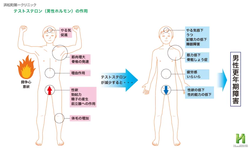 男性更年期障害