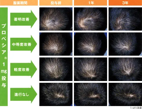 頭頂部写真評価例