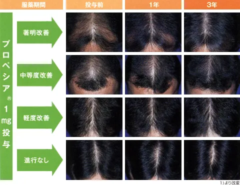 前頭部写真評価例