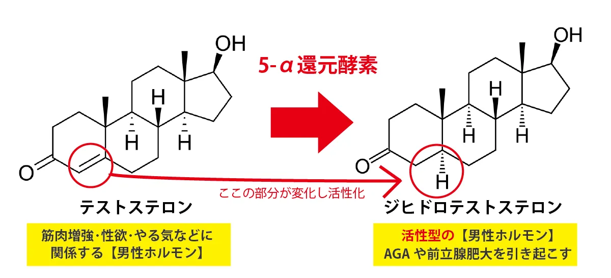 テストステロンとジヒドロテストステロン(DHT)の違いとAGAとの関係