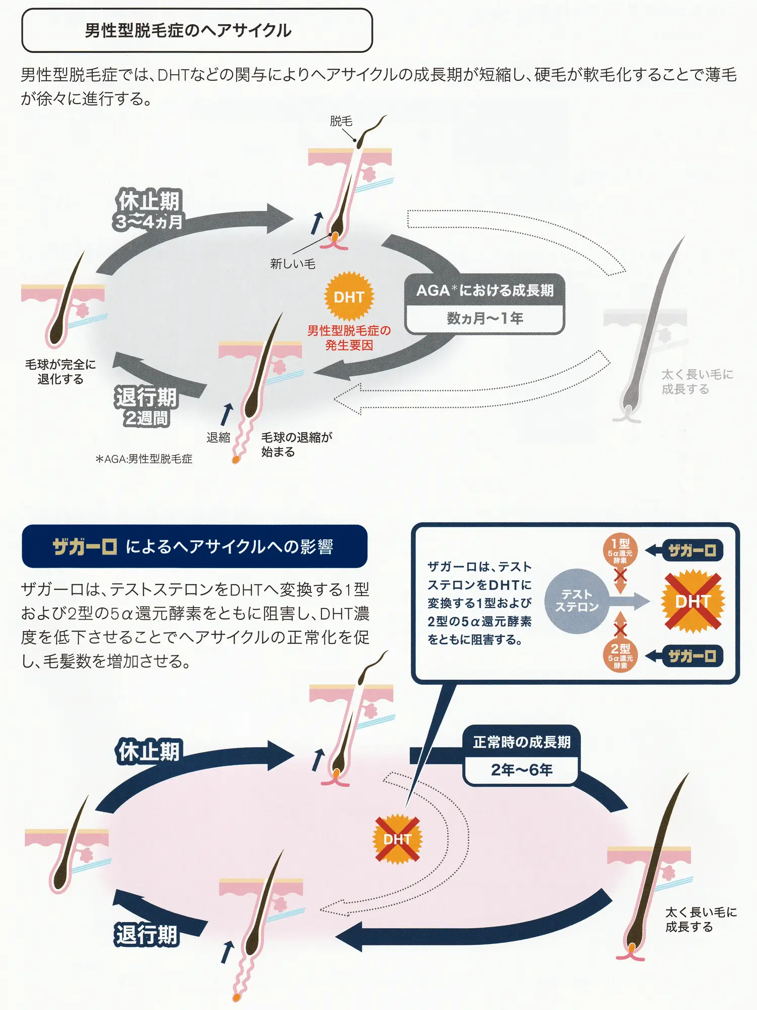 男性型脱毛症のヘアサイクル